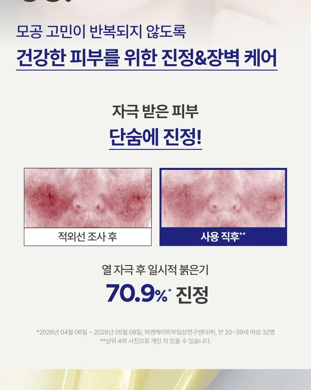 [UPGRADE] 이니스프리 레티놀 시카 모공 흔적 크림 50ml 기획(+30ml) 상세페이지 18